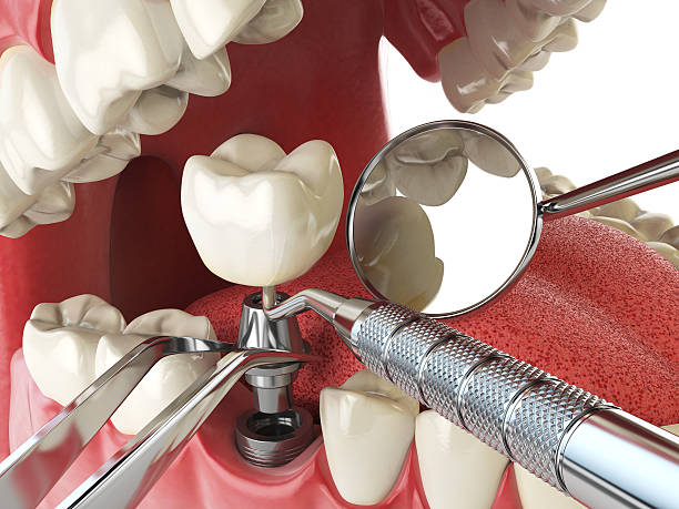 Best Root Canal Emergency Dentist  in Howell, MI